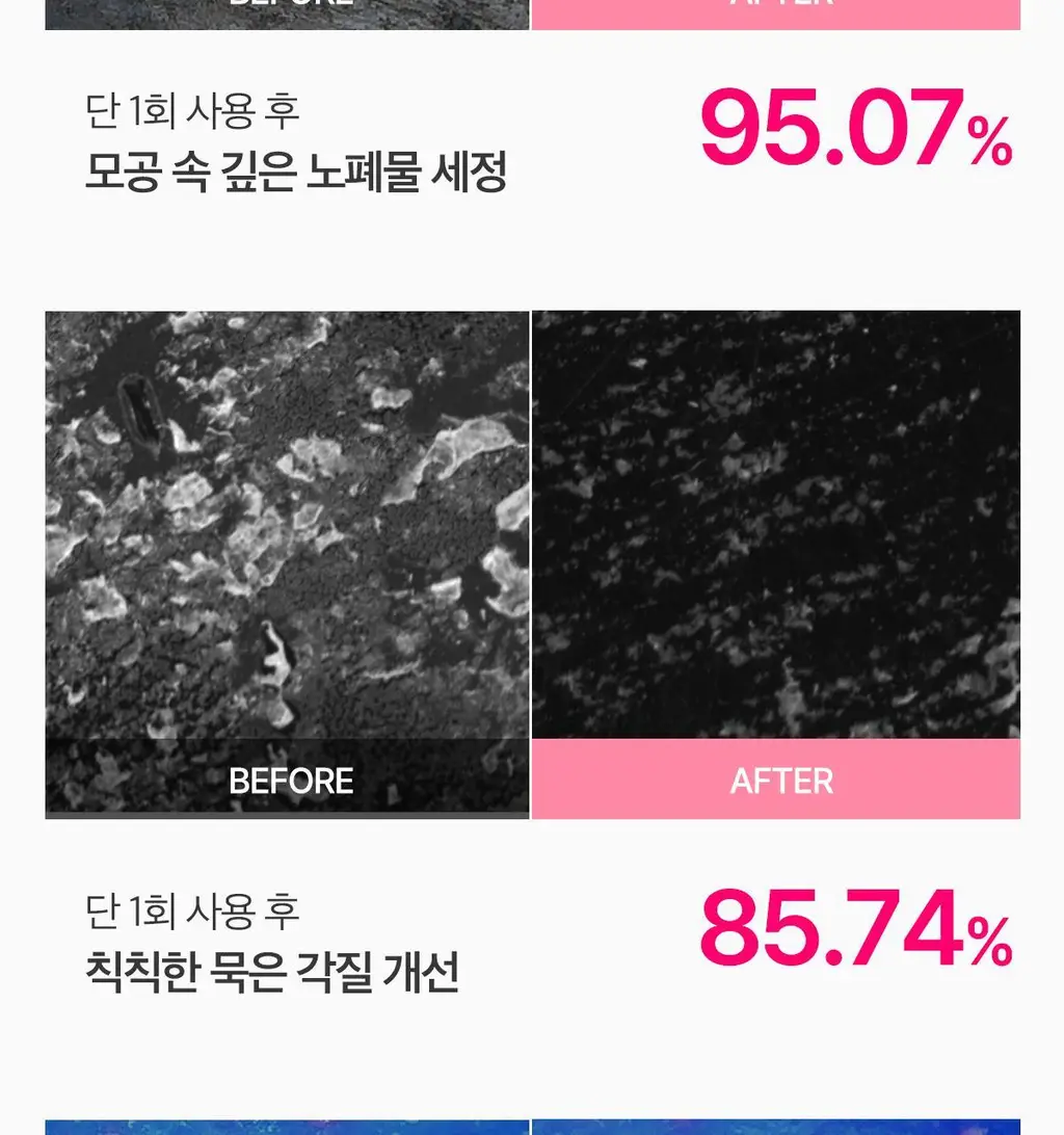 [피지뽑는] 에이프릴스킨 트라넥삼산 딥클렌저 120g 기획 (+15g 미니어처) 상세페이지 37
